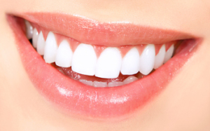 CFD can whiten your smile