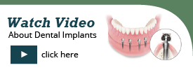 MDI Video
