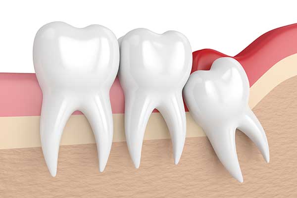 Tooth Repair & Treatments In Chanhassen MN