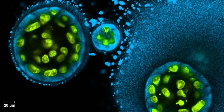 Amylase Image
