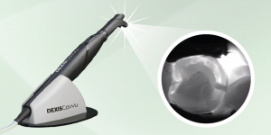Cavity Detector